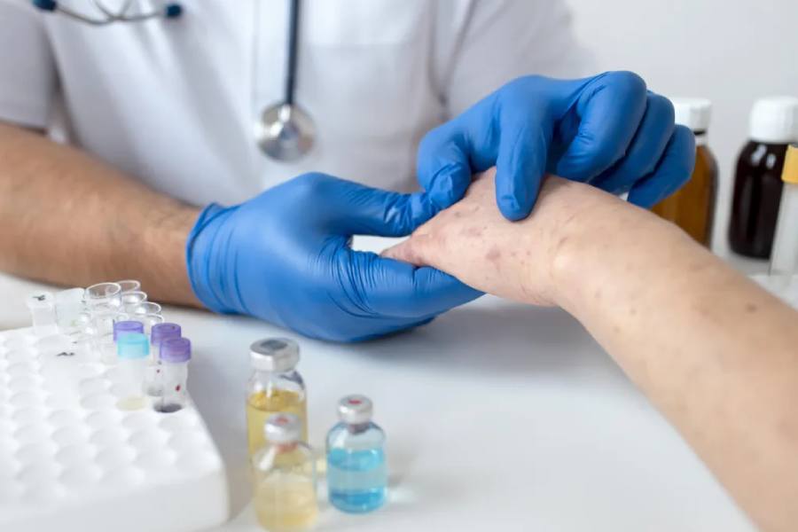 Lupus: la enfermedad que lleva al sistema inmune a atacar el propio organismo